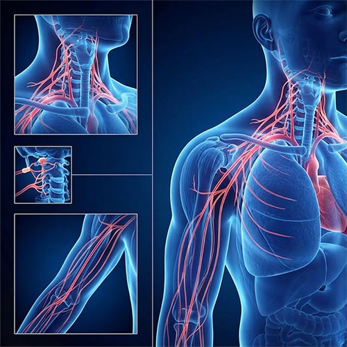 Risonanza Magnetica del Plesso Brachiale